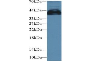 Detection of UCP4 in Mouse Cerebrum lysate using Polyclonal Antibody to Uncoupling Protein 4, Mitochondrial (UCP4) (SLC25A27 anticorps  (AA 21-317))