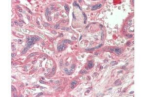 Human Placenta: Formalin-Fixed, Paraffin-Embedded (FFPE).