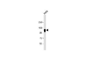Anti-CYLD Antibody at 1:4000 dilution + Hela whole cell lysate Lysates/proteins at 20 μg per lane. (CYLD anticorps  (AA 305-582))