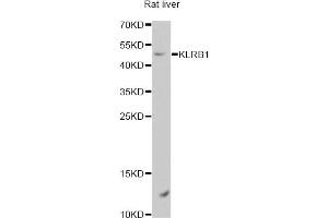 Western blot analysis of extracts of rat liver, using KLRB1 antibody. (CD161 anticorps)