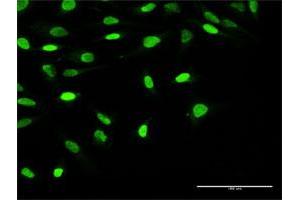 Immunofluorescence of purified MaxPab antibody to OBFC1 on HeLa cell.