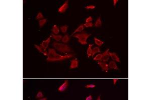Immunofluorescence analysis of MCF-7 cells using RARRES2 Polyclonal Antibody (Chemerin anticorps)