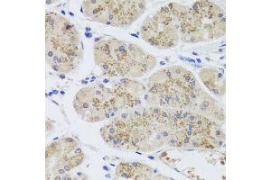 Immunohistochemistry of paraffin-embedded human stomach using MTERFD3 antibody. (MTERFD3 anticorps  (AA 1-250))