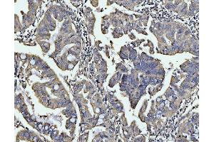 IHC analysis of BIN1 using anti-BIN1 antibody (ABIN7601780).