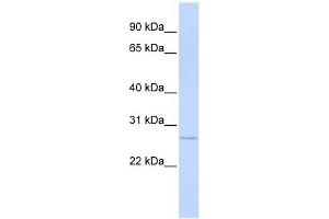 MTHFS antibody used at 1 ug/ml to detect target protein. (MTHFS anticorps)