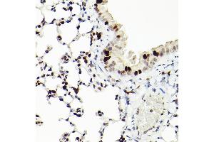 Immunohistochemistry of paraffin-embedded mouse lung using MCM2 Rabbit mAb (ABIN7268538) at dilution of 1:100 (40x lens).
