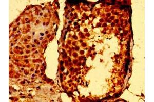 Immunohistochemistry of paraffin-embedded human testis tissue using ABIN7169686 at dilution of 1: 100