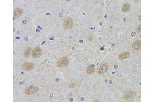 Immunohistochemistry analysis of paraffin-embedded rat brain using DLG4 Polyclonal Antibody at dilution of 1:100. (DLG4 anticorps)