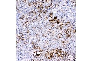 IHC analysis of GSTA1/A2/A3/A4/A5 using anti-GSTA1/A2/A3/A4/A5 antibody (ABIN5518995). (GSTA1 anticorps  (AA 2-222))