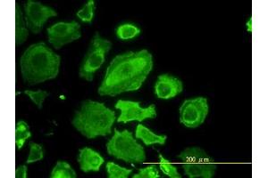 Image no. 4 for anti-Cell Division Cycle 37 Homolog (S. Cerevisiae) (CDC37) (AA 1-379) antibody (ABIN599169) (CDC37 anticorps  (AA 1-379))
