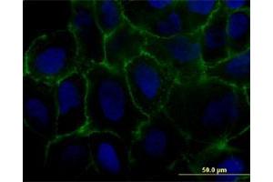 Immunofluorescence of monoclonal antibody to MCAM on U-2 OS cell. (MCAM anticorps  (AA 1-646))
