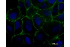 Immunofluorescence of monoclonal antibody to MCAM on U-2 OS cell. (MCAM anticorps  (AA 1-646))