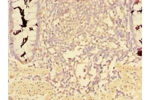 Immunohistochemistry of paraffin-embedded human colon tissue using ABIN7148068 at dilution of 1:100 (CCDC112 anticorps  (AA 201-446))