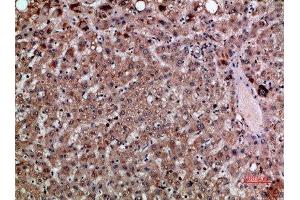 Immunohistochemical analysis of paraffin-embedded human-liver, antibody was diluted at 1:200