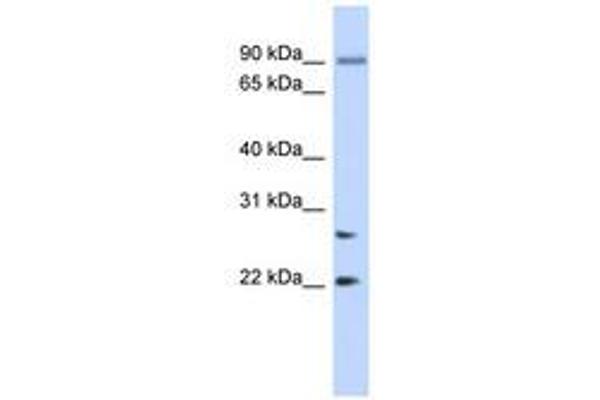 JOSD2 Antikörper  (AA 35-84)