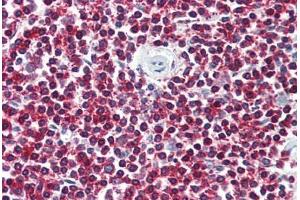 Anti-LGR6 antibody  ABIN1049008 IHC staining of human spleen. (LGR6 anticorps  (Internal Region))