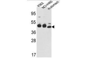 Image no. 1 for anti-Keratin 18 (KRT18) (C-Term) antibody (ABIN452897)