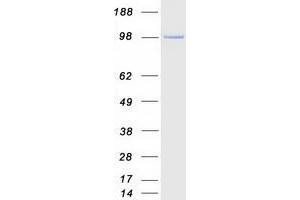 Validation with Western Blot