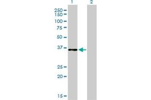 Western Blot analysis of CEBPE expression in transfected 293T cell line by CEBPE monoclonal antibody (M01), clone 7A4.