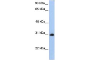 Western Blotting (WB) image for anti-Carbohydrate (N-Acetylgalactosamine 4-0) Sulfotransferase 14 (CHST14) antibody (ABIN2463248) (CHST14 anticorps)