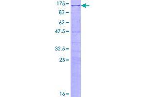 SDS-PAGE (SDS) image for SRSF Protein Kinase 1 (SRPK1) (AA 1-655) protein (GST tag) (ABIN1321342)