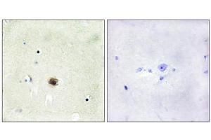 Immunohistochemistry analysis of paraffin-embedded human brain tissue using CSRP1 antibody. (CSRP1 anticorps  (Internal Region))