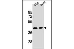 ADA Antibody (C-term) (ABIN1536621 and ABIN2843881) western blot analysis in CEM,Jurkat cell line lysates (35 μg/lane). (ADA anticorps  (C-Term))