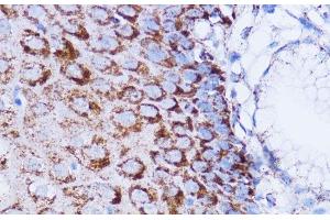 Immunohistochemistry of paraffin-embedded Human esophageal using NDUFB7 Polyclonal Antibody at dilution of 1:100 (40x lens).