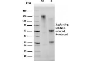 SDS-PAGE Analysis Purified CD68 Mouse Monoclonal Antibody (C68/2501). (CD68 anticorps  (AA 150-221))