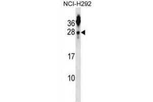 Western Blotting (WB) image for anti-Tetraspanin 2 (TSPAN2) antibody (ABIN2999038) (Tetraspanin 2 anticorps)