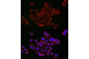 Immunofluorescence analysis of HeLa cells using Mitofusin 2 Rabbit pAb (ABIN6133825, ABIN6143800, ABIN6143803 and ABIN6216518) at dilution of 1:50 (40x lens).