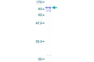 Image no. 1 for Papillary Renal Cell Carcinoma (Translocation-Associated) (PRCC) (AA 1-491) protein (GST tag) (ABIN1316133)