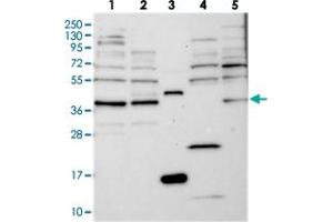 Western blot analysis of Lane 1: RT-4, Lane 2: U-251 MG, Lane 3: Human Plasma, Lane 4: Liver, Lane 5: Tonsil with FAXC polyclonal antibody  at 1:250-1:500 dilution. (C6orf168 anticorps)