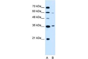 WB Suggested Anti-PARL Antibody Titration:  0. (PARL anticorps  (N-Term))