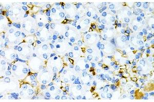 Immunohistochemistry of paraffin-embedded Mouse kidney using TAPBP Polyclonal Antibody at dilution of 1:200 (40x lens). (TAPBP anticorps)