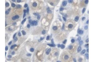 Detection of ARSA in Human Stomach Tissue using Polyclonal Antibody to Arylsulfatase A (ARSA) (Arylsulfatase A anticorps)