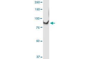 Immunoprecipitation of C1S transfected lysate using anti-C1S MaxPab rabbit polyclonal antibody and Protein A Magnetic Bead , and immunoblotted with C1S purified MaxPab mouse polyclonal antibody (B01P) .