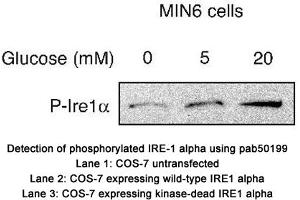 Image no. 2 for anti-Endoplasmic Reticulum To Nucleus Signaling 1 (ERN1) (pSer724) antibody (ABIN363508) (ERN1 anticorps  (pSer724))
