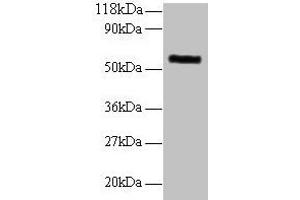 Western blot All lanes: MMP1 antibody at 2 μg/mL + 293T whole cell lysate Secondary Goat polyclonal to rabbit IgG at 1/10000 dilution Predicted band size: 55 kDa Observed band size: 55 kDa (MMP1 anticorps  (AA 101-469))
