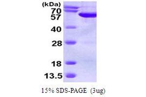Septin 6 (SEPT6) (AA 1-434) protein (His tag)