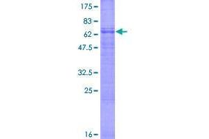 Image no. 1 for Blood Vessel Epicardial Substance (BVES) (AA 1-360) protein (GST tag) (ABIN7540271)