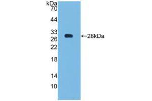 Western blot analysis of recombinant Human Bcl2. (Bcl-2 anticorps  (AA 2-211))