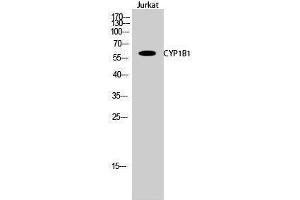 Western Blotting (WB) image for anti-Cytochrome P450, Family 1, Subfamily B, Polypeptide 1 (CYP1B1) (Internal Region) antibody (ABIN3184162)