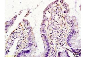 Formalin-fixed and paraffin embedded rat intestine tissue labeled with Anti-GM-CSF Polyclonal Antibody , Unconjugated at 1:200, followed by conjugation to the secondary antibody and DAB staining (GM-CSF anticorps  (AA 71-141))