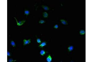 Immunofluorescent analysis of U251 cells using ABIN7168953 at dilution of 1:100 and Alexa Fluor 488-congugated AffiniPure Goat Anti-Rabbit IgG(H+L) (C7orf45 anticorps  (AA 56-244))