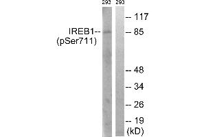 Immunohistochemistry analysis of paraffin-embedded human thyroid gland tissue using IREB1 (Phospho-Ser711) antibody. (Aconitase 1 anticorps  (pSer711))