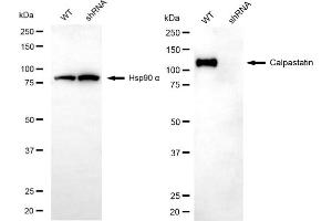 Western blotting analysis using calpastatin antibody (ABIN7797850).