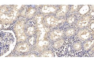 Detection of SMAD3 in Human Kidney Tissue using Monoclonal Antibody to SMAD family member 3 (SMAD3)