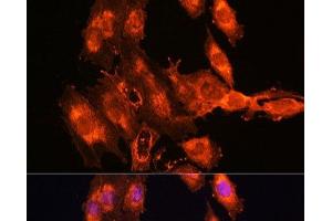 Immunofluorescence analysis of C6 cells using FSTL1 Polyclonal Antibody at dilution of 1:100. (FSTL1 anticorps)