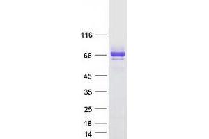 Validation with Western Blot